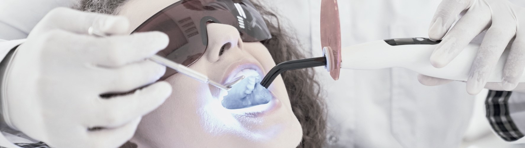 stomatologia zachowawcza w Bielany Dental, wypelnienia kompozytowe